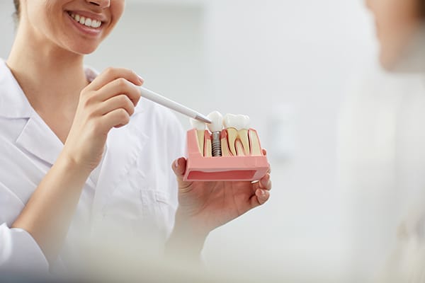 Why Choose a Dental Implant? 2 Good Dentist 5