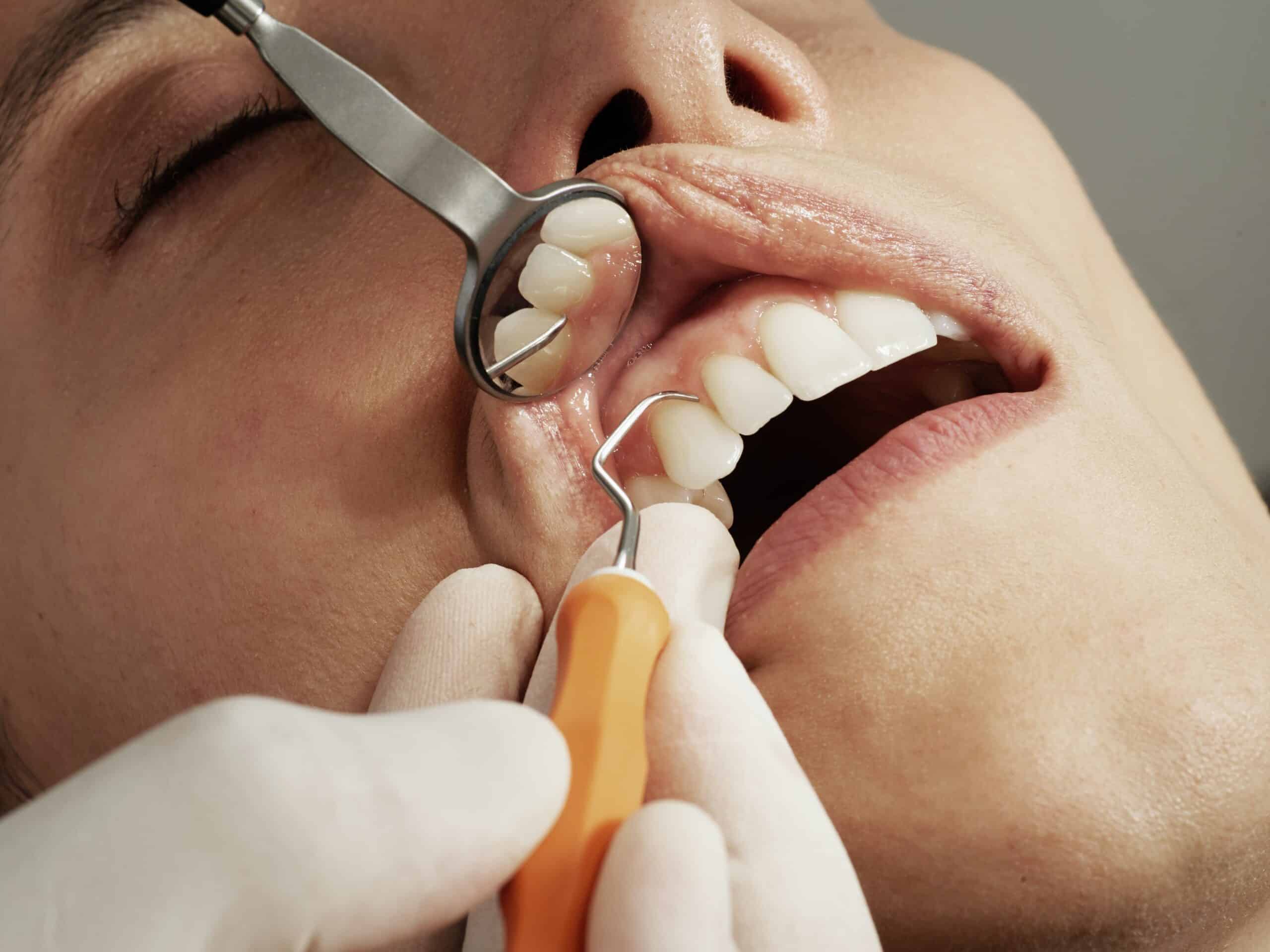 Dentist Near Me New Rochelle New York