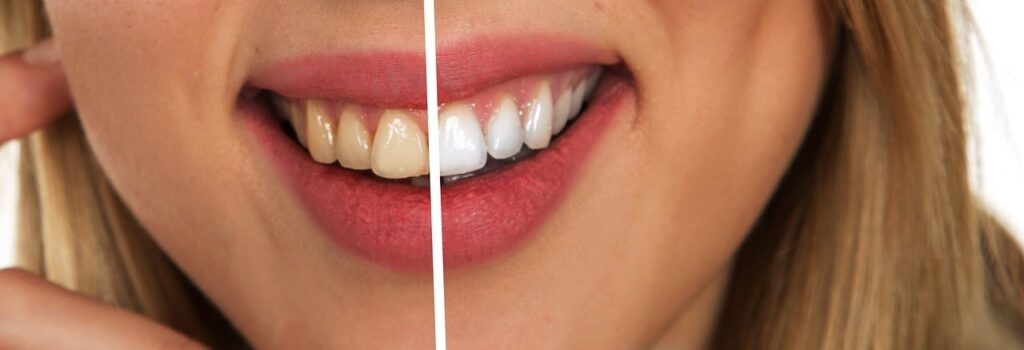 Dentist Near Me Springfield Missouri