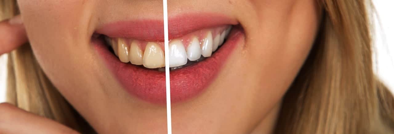 dentist near me springfield missouri 3