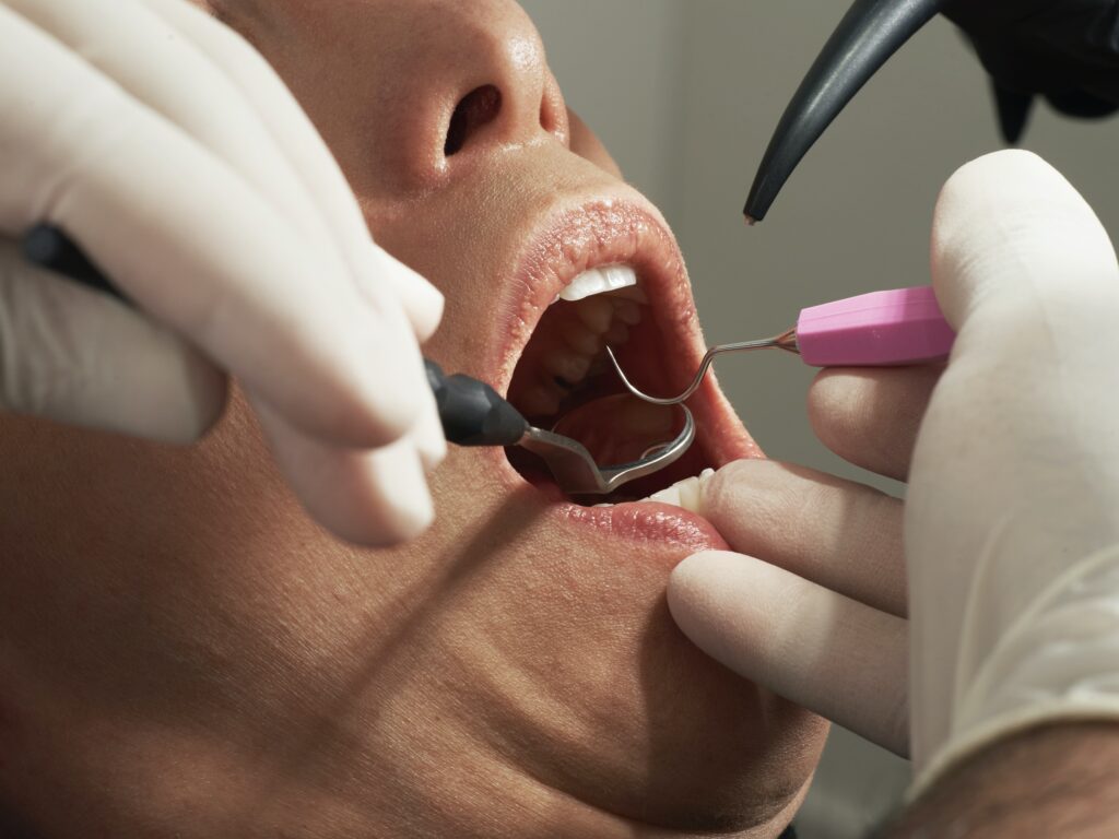 Dentist Near Me Vancouver Washington