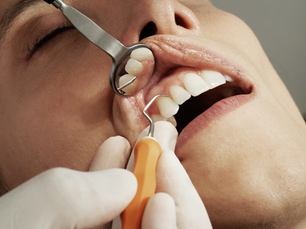 Demystifying Dental Insurance: Finding Dentists Near Me with Medicaid Options