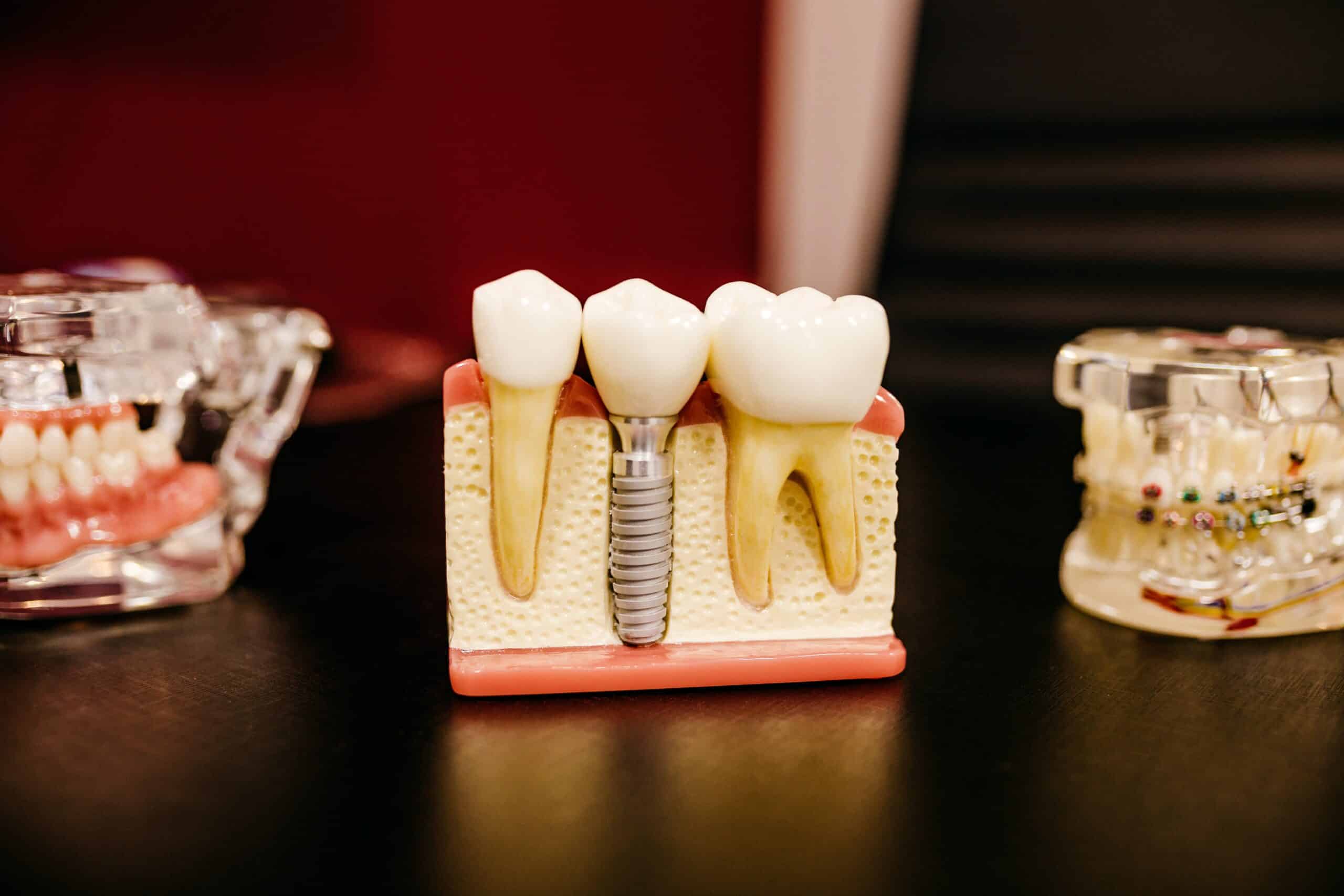 Dentist Near Me Sandy Springs Georgia