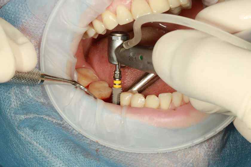 Dentist Near Me Eastlake