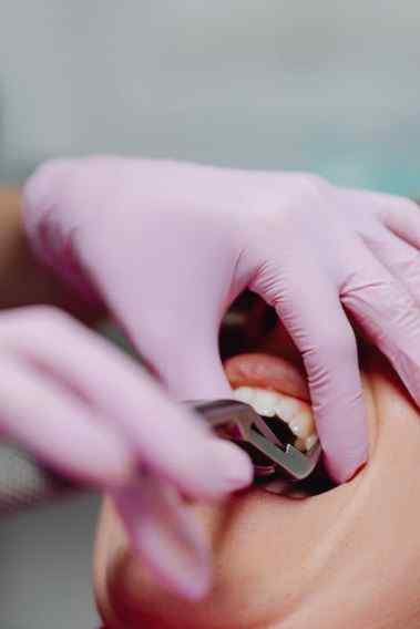 Your Smile, Your Health: Locating Dentists Near Me Who Accept Medicaid