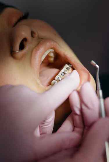 Dentist Near Me Braces