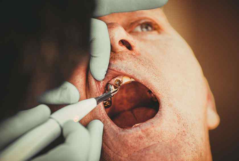 No Insurance? No Problem! Discover Dentists Near Me Who Take Medicaid