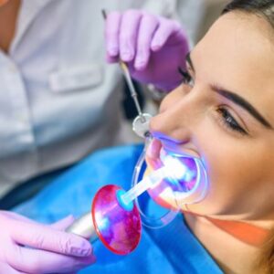 dental bleaching10