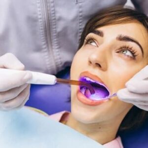dental bleaching8