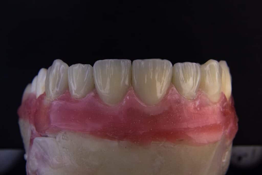 Photo Dental surgery