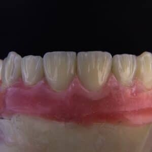 Photo Dental surgery