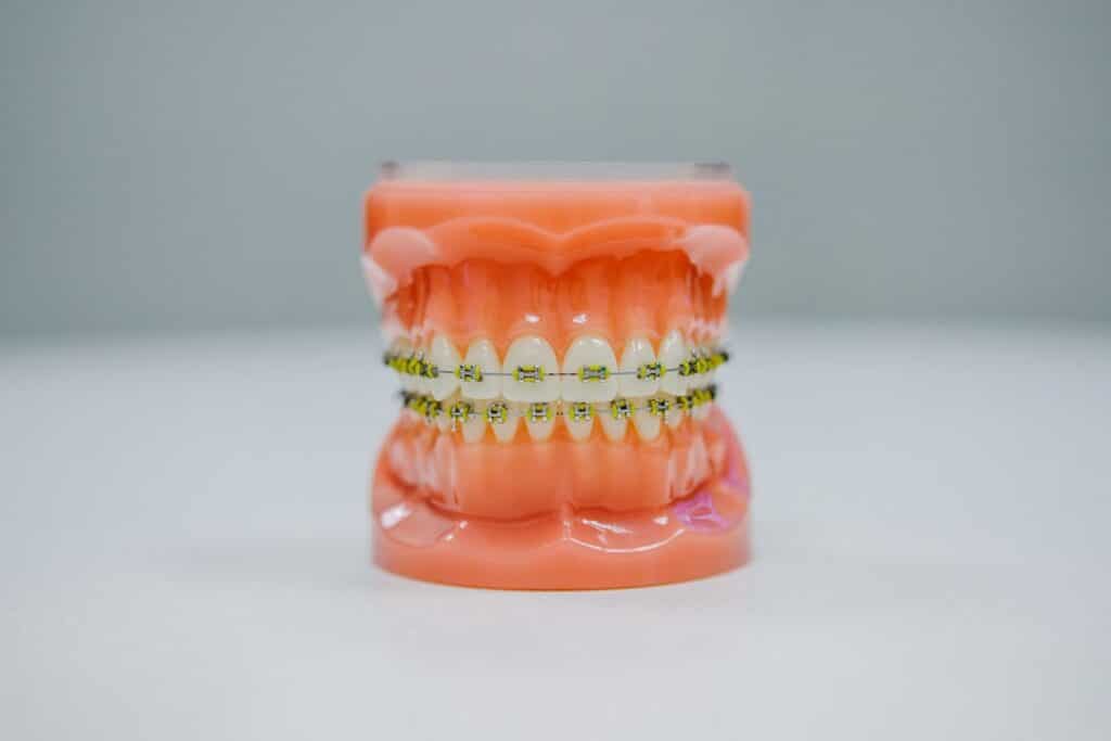 Photo Swollen gums