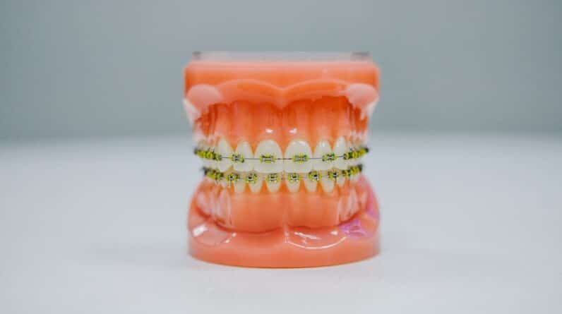 Photo Swollen gums