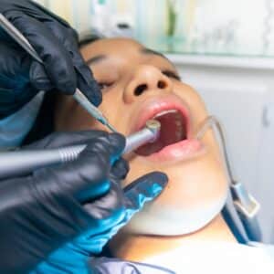 Photo Sensitive teeth