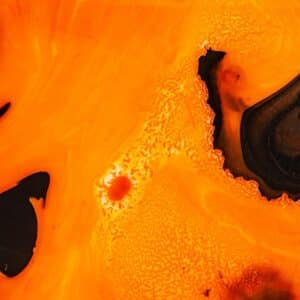 Photo Bacteria proliferation