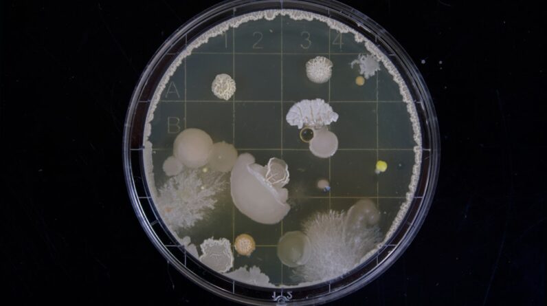 Photo Throat bacteria