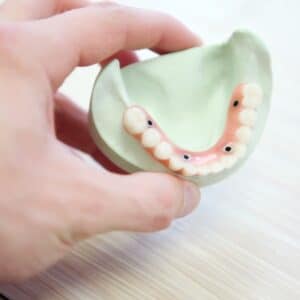 Photo Dental filling