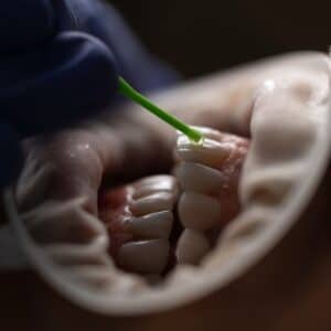 Photo Decayed tooth