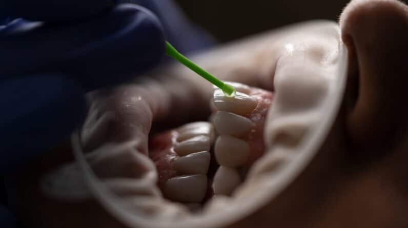 Photo Decayed tooth