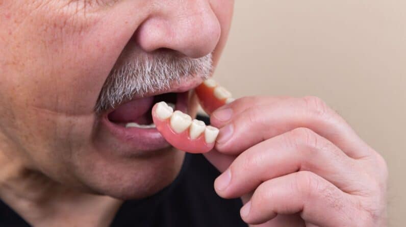 Photo Dental X-ray