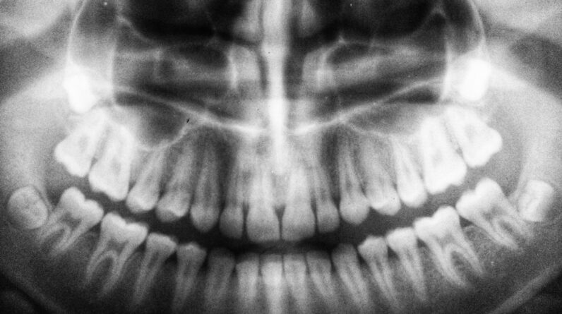 Photo Dental X-ray