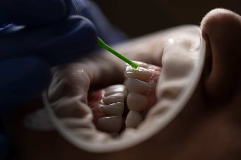 Photo Rotten teeth
