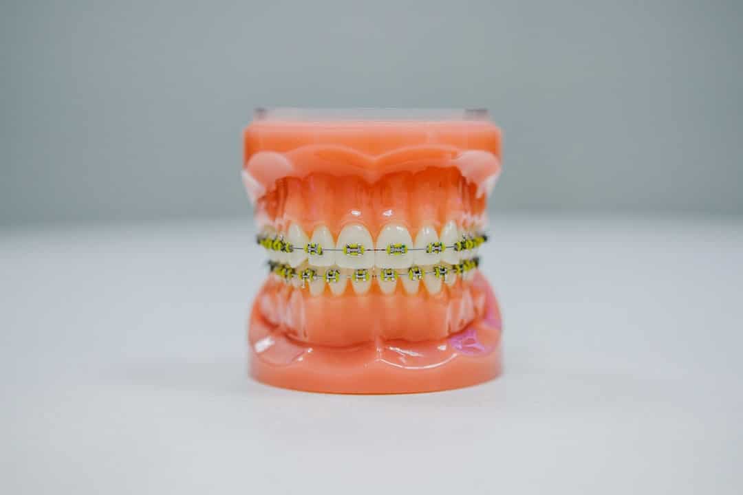 Photo No cavities