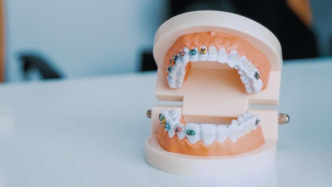 Photo Tooth decay