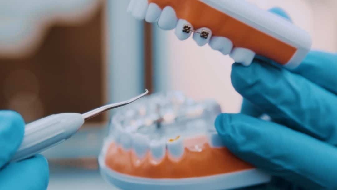 Photo Tooth decay
