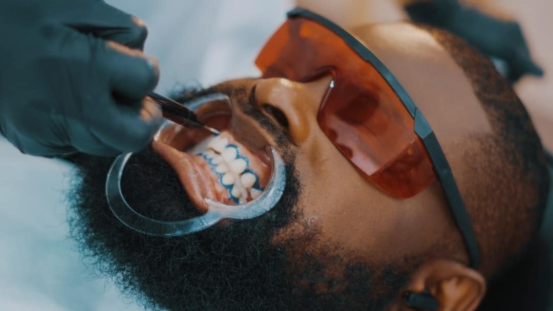 Photo Tooth decay