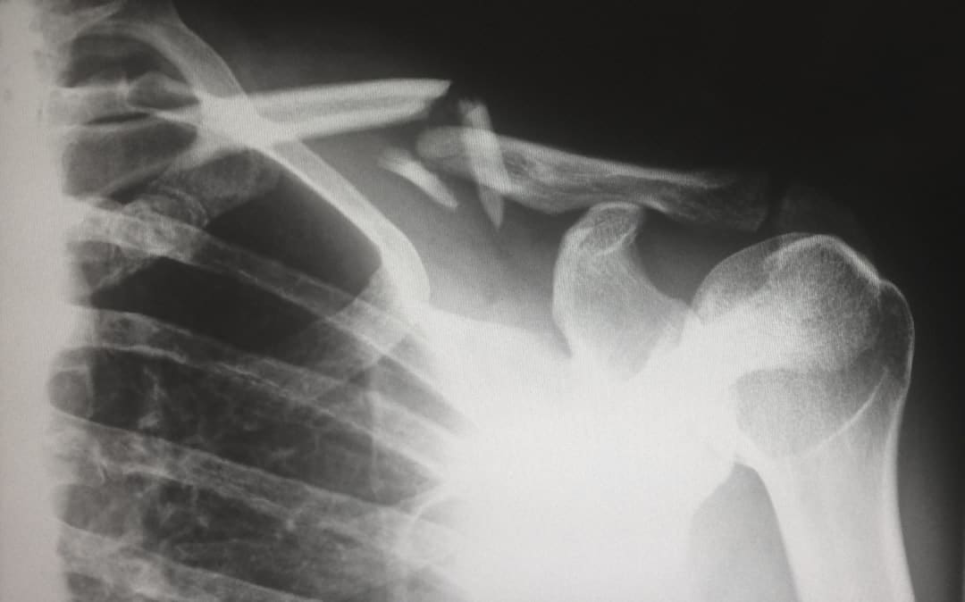 Photo Tooth X-ray