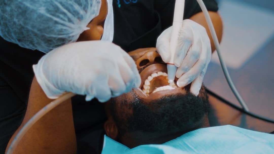 Photo Tooth decay