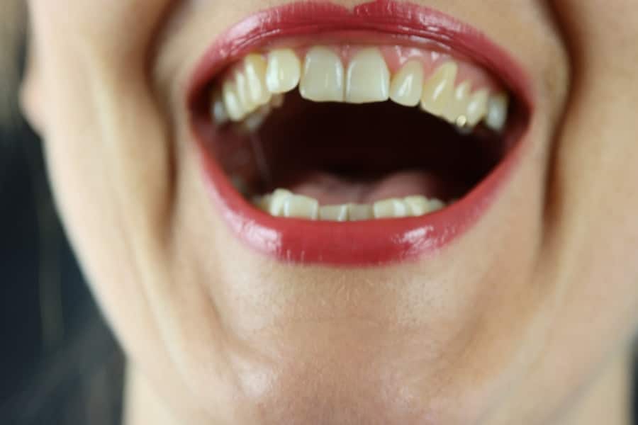 Photo "Common Dental Problems and How to Prevent Them"