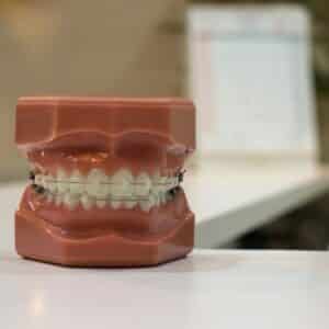 Photo "What Documentation is Required to Prove Medical Necessity for Cosmetic Dental Procedures Under Medicare?"