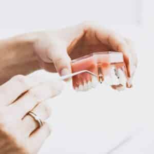 Photo "Are There Any Waiting Periods for Cosmetic Dental Coverage Under Medicare?"