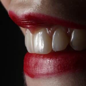 Photo "What Alternative Financing Options Exist for Cosmetic Dental Work Not Covered by Medicare?"