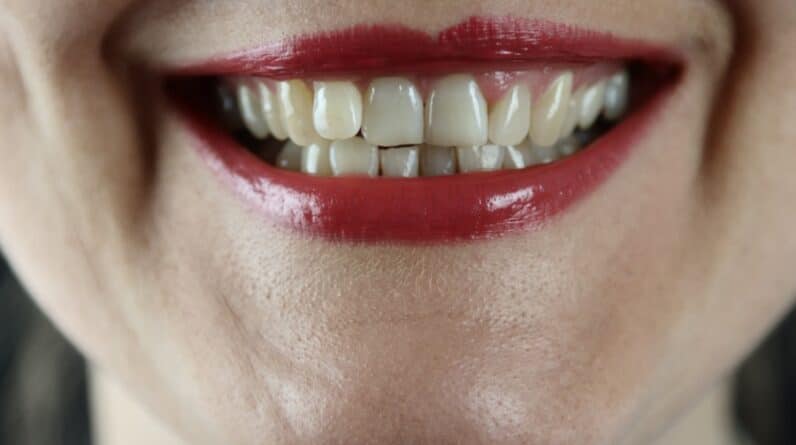 Photo "Are There Any Medicare Advantage Plans That Offer Better Coverage for Cosmetic Dentistry?"