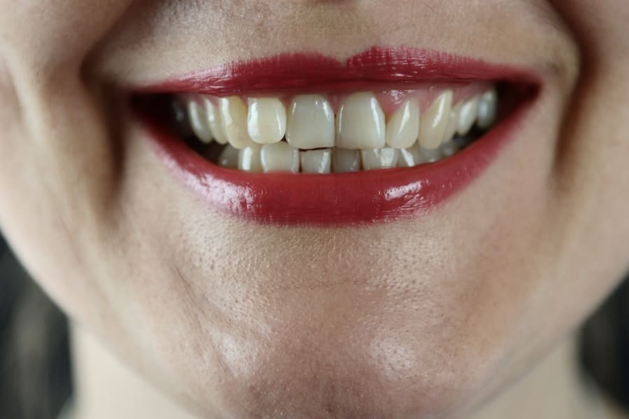 Photo "Are There Any Medicare Advantage Plans That Offer Better Coverage for Cosmetic Dentistry?"