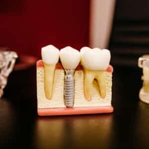 Photo "Best Dentist and Dental Clinic In Akron Ohio"