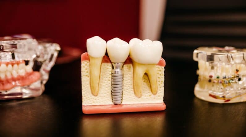 Photo Dentist