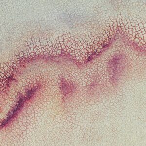 Photo Dental Infection