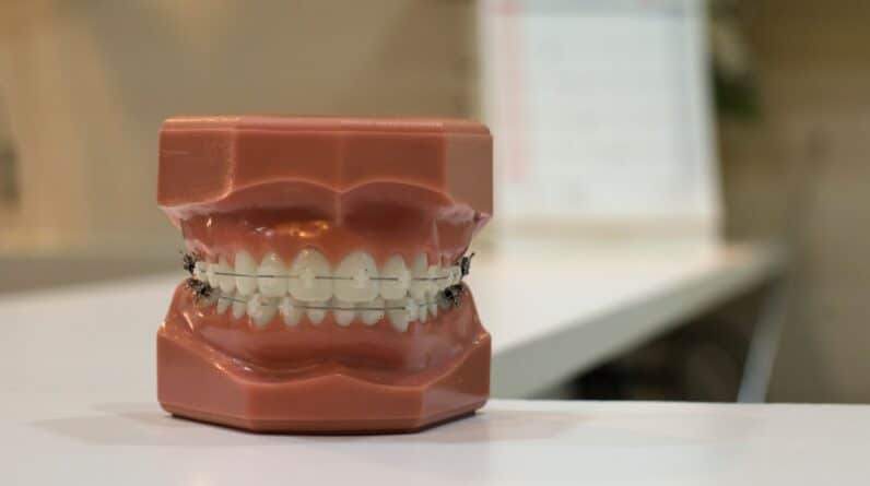 Photo Tooth Sensitivity