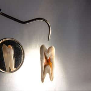 Photo Dental Check-up