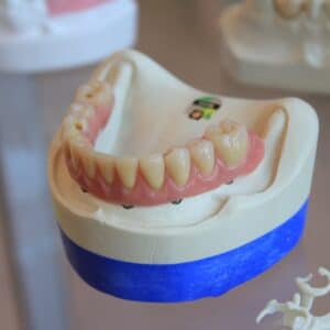 Photo Dental Crowns