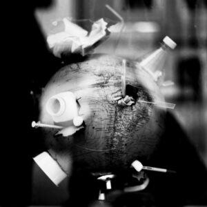 Photo Dentists, Bruxism