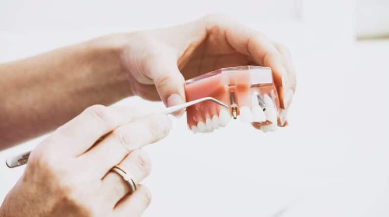 Photo Dental Fluoride Treatments