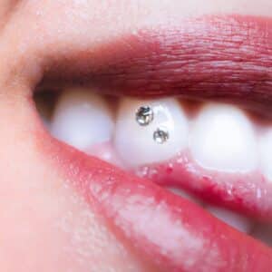 Photo Dentists, Braces Issues