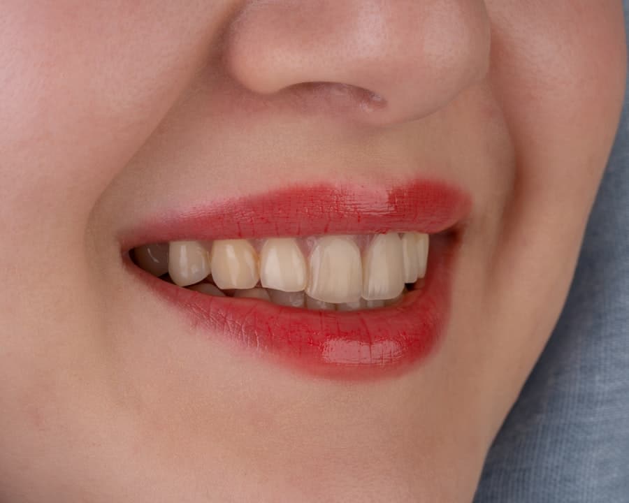 Cosmetic Dental Treatments