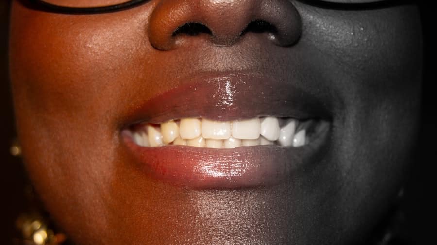 Teeth Whitening Chandler Az 2 Teeth Whitening Chandler Az