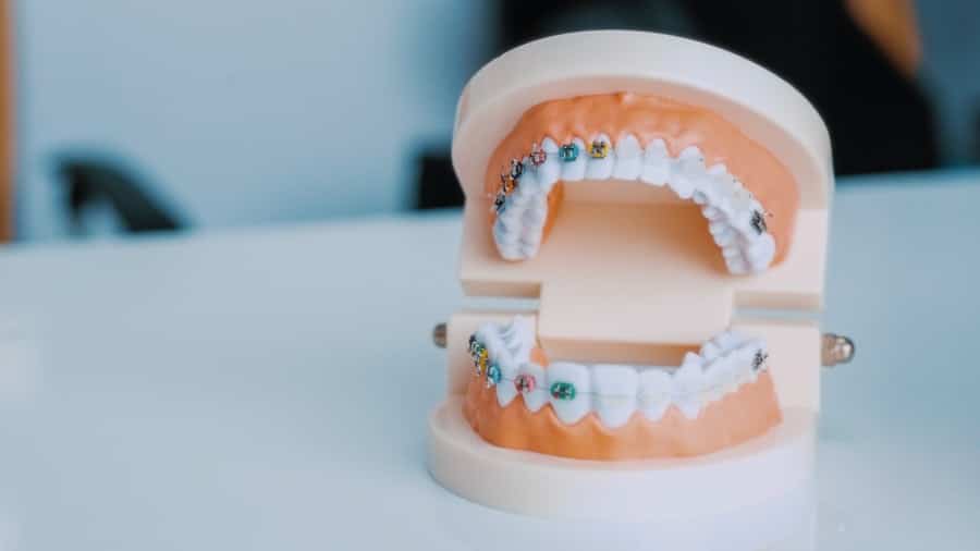 Laser Dentistry